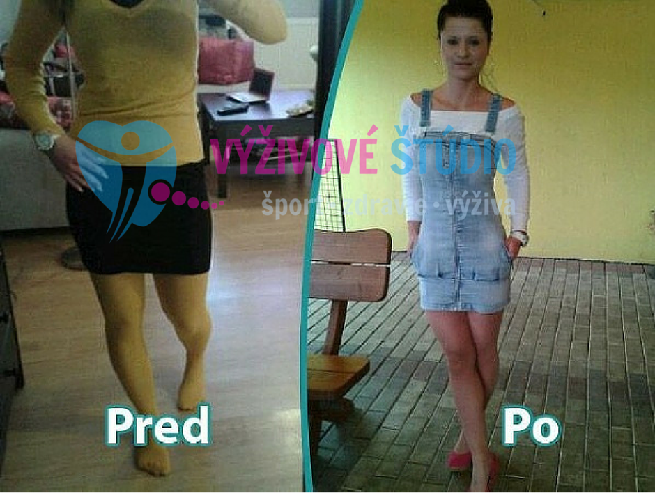 Redukcia a formovanie postavy